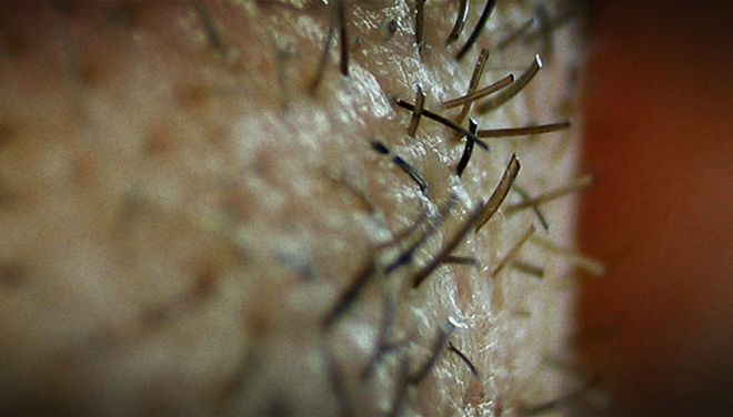 Stubble close up